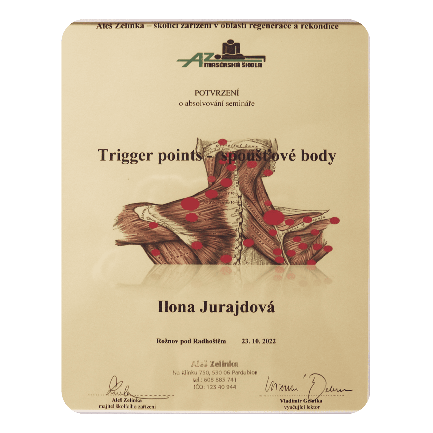Trigger points – spoušťové body